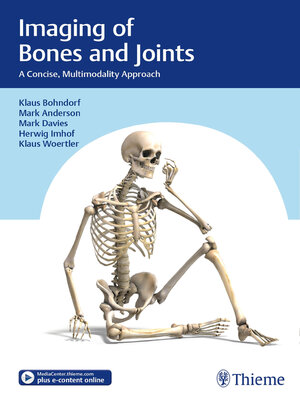 cover image of Imaging of Bones and Joints
